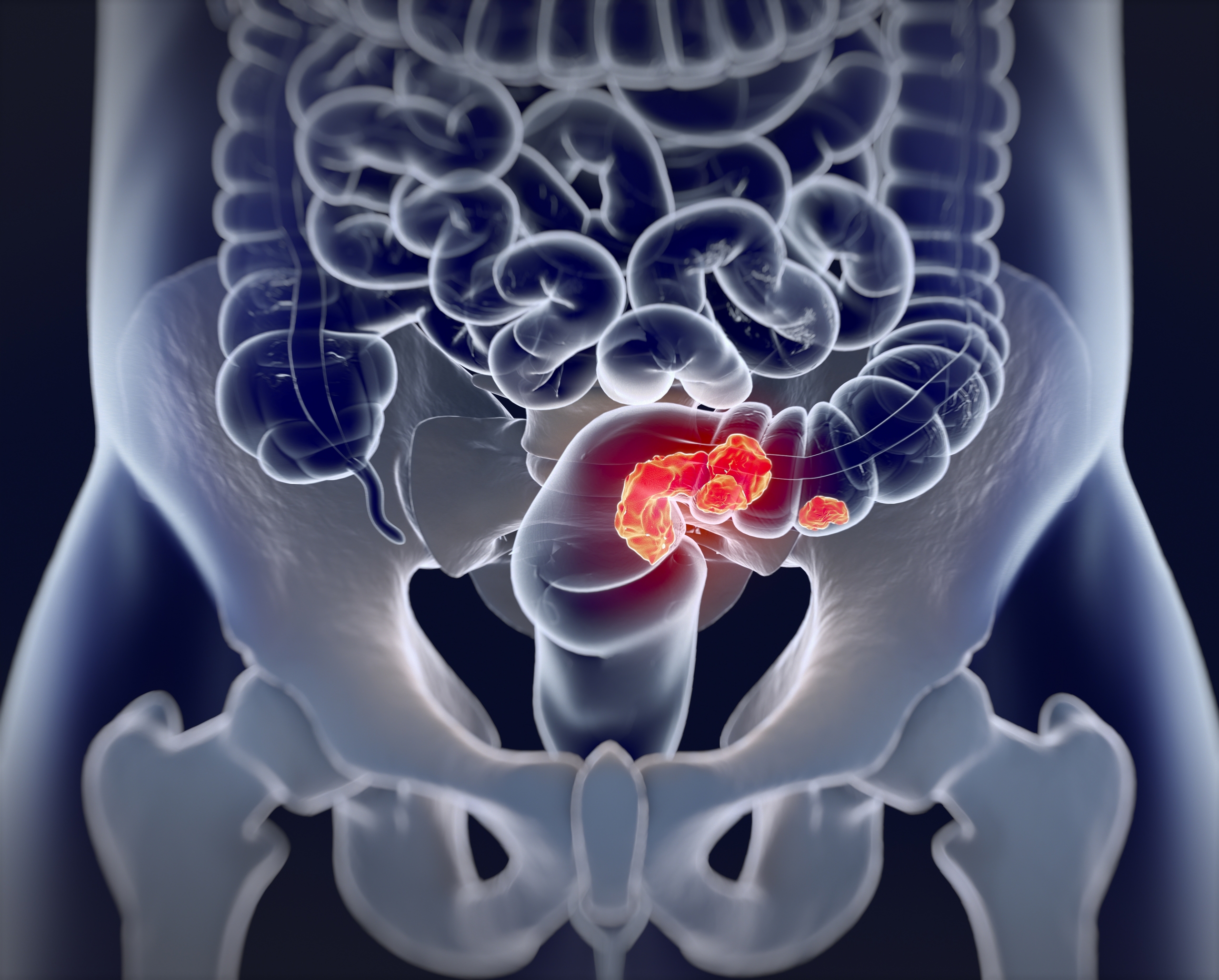Gastroenterology & Hepatology